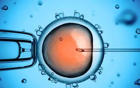体外受精 IVF-ET